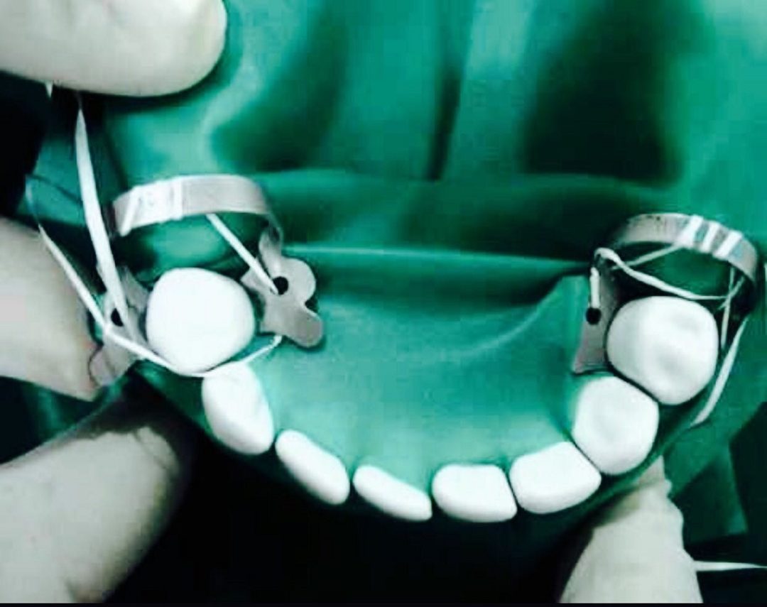 rubberdamplacementcourse Buddha Dental Tree