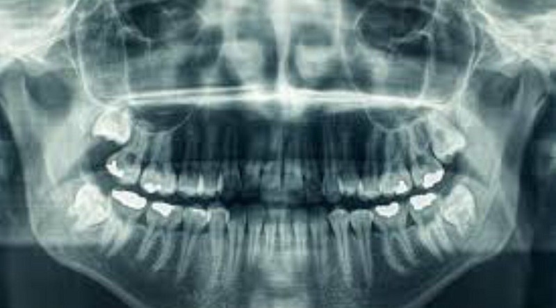 CERTIFICATE IN DENTAL RADIOGRAPHY